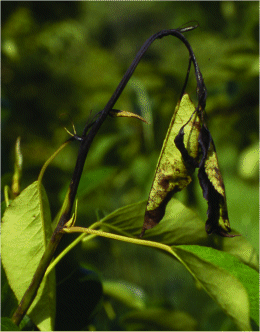 سوختگی آتشی